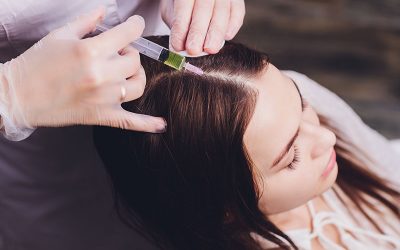 مزوتراپی مو بهترین روش درمان ریزش مو