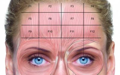 تزریق بوتاکس پیشانی و نکات مهم آن